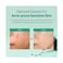 Somebymi AHA BHA PHA 14 Days Super Miracle Spot All Kill Cream 30ml