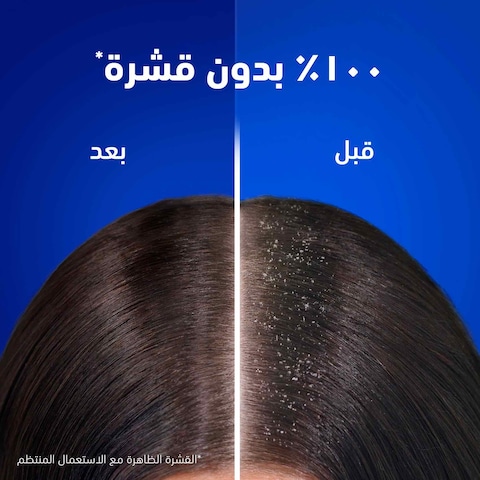 Head &amp; Shoulders&nbsp;Apple Fresh&nbsp;Anti-Dandruff Shampoo for Greasy Hair, 400ml