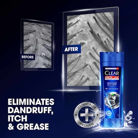 Clear Shampoo For Men Anti Dandruff Shampoo Deep Cleanse 400ml