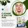 Bliss Of Earth Alcohol Free Witch Hazel Gel For Acne, Hemorrhoids &amp; Puffy Eyes, Pack Of 3x100gm