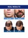 6-Pack Minoxidil 5% Extra Strength Hair Regrowth Solution &ndash; 60ml Bottles for Thicker, Fuller Hair