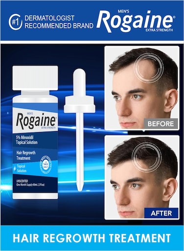 Mens Rogaine Extra Strength 5% Minoxidil Topical Solution Hair Regrowth Treatment Oil 60ml