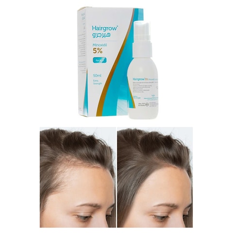 Hairgrow 5% Minoxidil Solution 50 ML Effective Hair Regrowth Treatment (Pack of 3)