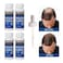 Pack Of 4 Minoxidil 5% Extra Strength Hair Regrowth Bottles 60ml