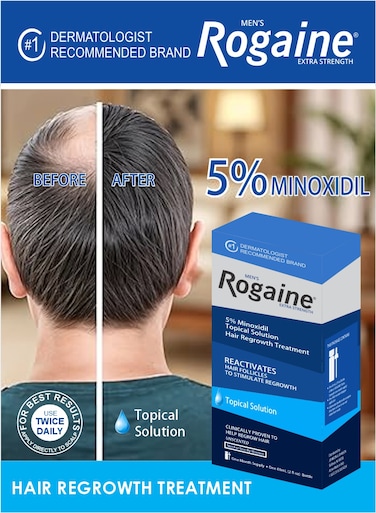 Mens Rogaine Extra Strength 5% Minoxidil Topical Solution Help Regrow Hair Oil 60ml