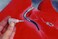 Polyvance PlastiFix Kit (Black)