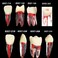 SEUJJRO 7Pcs Teeth Root Canal Model Endodontic File RCT Practice Pulp for Teaching Study