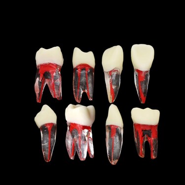 SEUJJRO 7Pcs Teeth Root Canal Model Endodontic File RCT Practice Pulp for Teaching Study