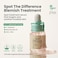 Axis-Y Spot The Difference Blemish Treatment 15ml / 0.5 Fl. Oz, Hydrating Gentle Acne Spot Treatment, Acne Care, Korean Skincare