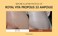 Honey Nourishing Essence?Royal Vita Propolis 33 Ampoule?Korean Skin Care Contains Royal Jelly Extract, Panthenol?Effective Vitamin Serum Strengthen The Skin Moisturizing, Soothing?