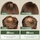 Hair Growth Oil With Biotin - Caffeine And Castor Oil For Fuller, Thicker, Longer Hair