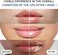 Lip Sleeping Mask(20G), Lip Collagen, Lip Mask Overnight, Lip Plumper Advanced With Hyaluronic Acid, Lip Balm With Peptide Complex For Lip Wrinkles Repair Overnight Lip Masks