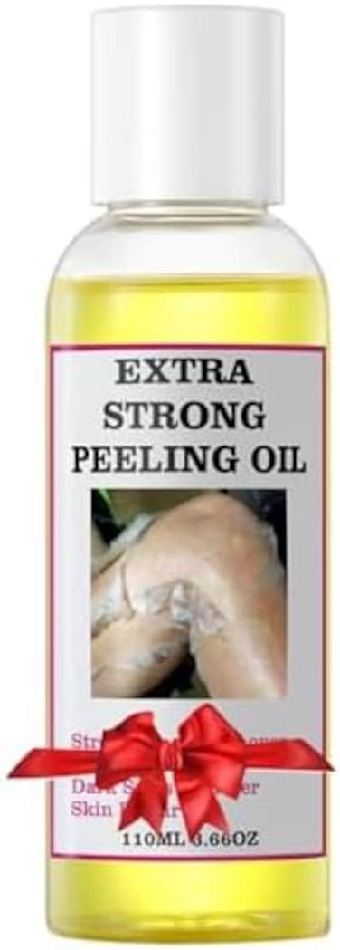 Peeling Oil For Dark Skin, Yellow Peeling Oil With Salicylic Sodium Hyaluronate, Strong Peeling Oil Extra Strength, Exfoliating Peeling Solution For Body All Skin Type - 110ml/3.66 Oz
