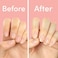 First Aid Kiss" Nail Strengthener And Growth Treatment- Nail Repair Solution &amp; Growth Treatment For Thin, Brittle &amp; Damaged Nails - Nail Hardener With Vitamin E (0.45 Fl Oz)