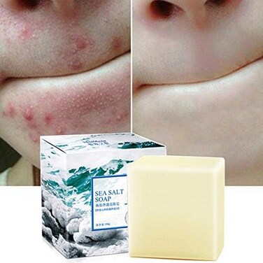 Fabulure Soap With Sea Salt Natural Goat's Milk For Face Dry And Natural Oily Skin, Remove Acne Anti-Cellulite Soap (100ml)