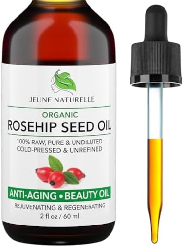 Rosehip Oil - 100% Pure Raw Organic, Virgin, Cold-Pressed, Unrefined For Anti Aging, Acne Eczema Wrinkles Dark Spots Scars Rosacea - Face Serum Oil - Anti Aging Beauty Rose Hip Oil, 2Oz