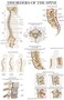 2 Pack: Spinal And Cranial Nerves + Disorders Of The Spine Poster Set - Set Of 2 Anatomical Charts - Laminated - 18" X 24
