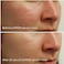 Natural Miracle Mist Face Spray, Soothes Redness + Irritation, Promotes Healthy, Calm, Clear Skin, Hypochlorous Acid (Mini, 1 Oz, 30 ml)