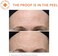Dr Dennis Gross Skincare Alpha Beta Peel Ultra Gentle