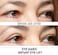 Eye Magic Original Eye Lift Kit (Small/Medium)