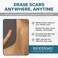 BIODERMIS Xeragel 100% Silicone Scar Treatment Ointment &mdash; Clinically Proven to Reduce the Appearance of Old &amp; New Scars &mdash; Sealed Tube, 10g