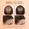 BosleyMD BosRevive Volumizing Conditioner for Noticeably Thinning Hair (Color Safe). Color-Treated 10.1 Fl Oz