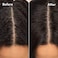 Mizani Scalp Care Dandruff Shampoo   Pyrithione Zinc   Cleanses Hair &amp; Scalp   For Curly Hair   16.9 Fl Oz