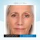 Serious Skincare INSTA-TOX Instant Wrinkle Smoothing Serum - Improves appearance of Fine Lines &amp; Wrinkles - Temporary Skin Tightener - Instant Line Filler - Two .75 Fl Oz Tubes (2Pack)