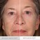 Serious Skincare INSTA-TOX Instant Wrinkle Smoothing Serum - Improves appearance of Fine Lines &amp; Wrinkles - Temporary Skin Tightener - Instant Line Filler - Two .75 Fl Oz Tubes (2Pack)