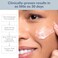 Clearogen Sensitive Skin Sulfur Acne Lotion, Acne Treatment, Sulfur Cream, Sulfur Ointment, Sulfur Spot Treatment, Sulfur Acne Treatment Cream 1.8 FL Oz