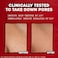 Thayers Alcohol-Free Witch Hazel Facial Toner With Aloe Vera Formula, Rose Petal, 12 Fl Oz