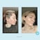 PERFECT IMAGE Hydro-Glo 10% Daily Use Peel Pads Enhanced with Lactic Acid, Mandelic Acid, Glutathione, Kojic Acid, Licorice, Papaya, Pineapple, Bearberry Extracts -