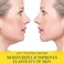Doppeltree Double Chin Reducer &amp; Remover - V Line Lifting Mask - Face Slimmer - Lifts, Tightens Jawline and Chin - Formulated in San Francisco (5 Masks)