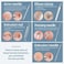 JPNK Blackhead Remover Tool Comedones Extractor Acne Removal Kit for Blemish, Whitehead Popping, 6 Pcs Zit Removing for Nose Face Tools with a Leather Bag