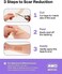 AWD Medical Soft Silicone Tape for Scars Removal with Silicone Gel Sheeting (1. 6inx 120in.