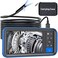 Teslong Dual Lens Endoscope Camera, 1080P Dual Camera Borescope Inspection Camera with 4. 5" IPS Monitor-16ft Waterproof Snake Camera-LED Ring Light-32GB MicroSD Card-Chargeable Battery -Carrying Case