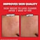 THAYERS Witch Hazel Blemish, White, Cleanser, Lemon, 4 Fl Oz.