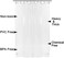 Barossa Design Shower Curtain Liner with 6 Weighted Magnets - Heavy Duty PEVA Plastic Shower Curtain for Bathroom, Waterproof VinylSee Through Shower Liner, Metal Grommets - Clear, 72x72.