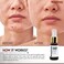Neoprosone, Dark Spot Gel Cream - 1 Fl oz / 30 ml - Gel Cream for Face, Reduce acnes, Sun Spots, Age Spots on Face, Knees, Elbows, Hands, Private Areas.