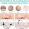 VOYOR Blackhead Remover Vacuum - Electric Vacuum Suction Facial Pore Cleaner Acne Whiteheads Comedone Extractor Kit for Men and Women Including 6 Suction Heads and 5 Suction Levels BR510.