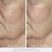 Obagi Medical ELASTIderm Facial Serum &ndash; Firming Face Serum with Patented Bi-Mineral Contour Complex Clinically Proven to Target Signs Of Skin Aging &ndash; 1 oz.