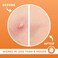 KEYCONCEPTS Acne Patches (120 Countwith Tea Tree Oil, Hydrocolloid Pimple Patches for Face - Zit Patch Acne Dots - Cystic Acne Patches Treatment - Pimple Patch with 3 Size Acne Stickers.