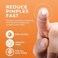 KEYCONCEPTS Acne Patches (120 Countwith Tea Tree Oil, Hydrocolloid Pimple Patches for Face - Zit Patch Acne Dots - Cystic Acne Patches Treatment - Pimple Patch with 3 Size Acne Stickers.