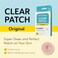 DERMA ANGEL Ultra Invisible Acne Patches, Pimple Patches, Hydrocolloid Acne Patches, Zit Patches, Hydrocolloid Bandages, Acne Spot Treatment - DayNight Use 48 Pieces 2 Sizes.
