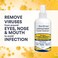 SkinSmart Antimicrobial Facial Cleanser Spray to Remove Viruses and Bacteria Around Eyes, Nose and Mouth, Fight Maskne, 8 oz Spray Non-Irritating Hypochlorous Spray.
