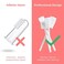 dearlomum Baby Tongue Cleaner, Newborn Toothbrush, 48PCS Disposable Infant Toothbrush Clean Mouth,Gauze Gum Cleaner Oral Cleaning Stick Dental Care for 0-36 Month.