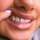 مجموعة أدوات تجميل الأسنان الاحترافية من سويت سمايل جيمز، مجموعة أدوات تجميل الأسنان للمبتدئين، صنع في لوس أنجلوس، كاليفورنيا.
