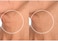 SiO Beauty FaceLift Neck, Forehead, EyeSmile Anti-Wrinkle Patches Overnight Smoothing Silicone Patches For Face, Neck, Forehead, EyeSmile Fine Lines And Signs Of Ageing.
