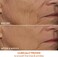 Dr Dennis Gross Dr. DRx SpectraLite Dpl FaceWare Pro: Smooths Full Face Fine Lines and Wrinkles, Firms Skin, Prevents Acne Flare-Ups, and Reduces Redness and Irritation.