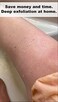 Watch Me Glow Silk Exfoliating Glove 100% Turkish Silk DEEP EXFOLIATING Body Scrubber Dead Skin Removal Body Exfoliator SMOOTHS SKIN and Keratosis Pilaris Exfoliating Mitt.